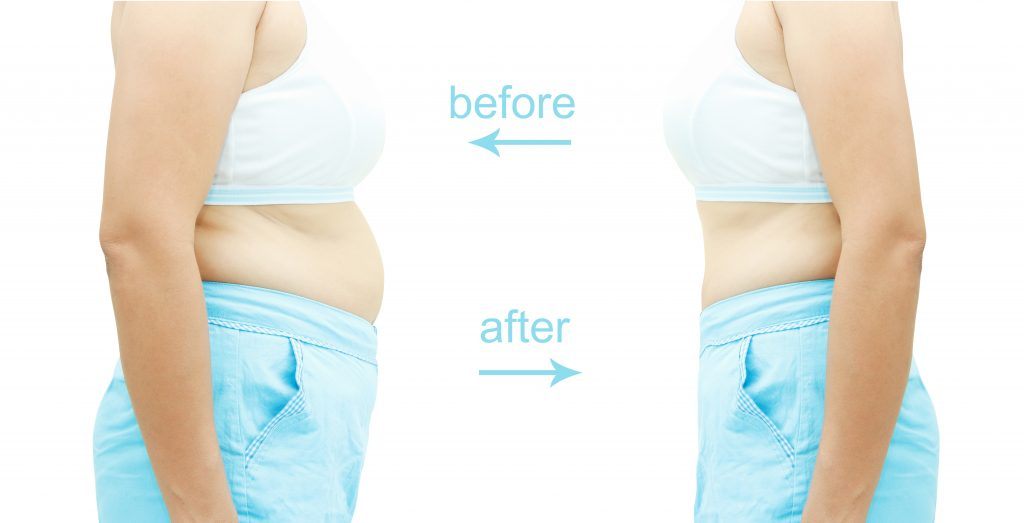 What Is Coolsculpting?