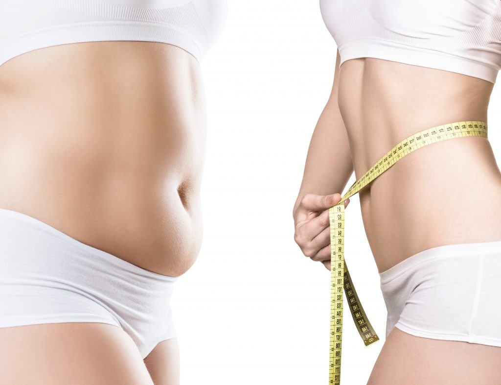 What to Expect from BMI Coolsculpting