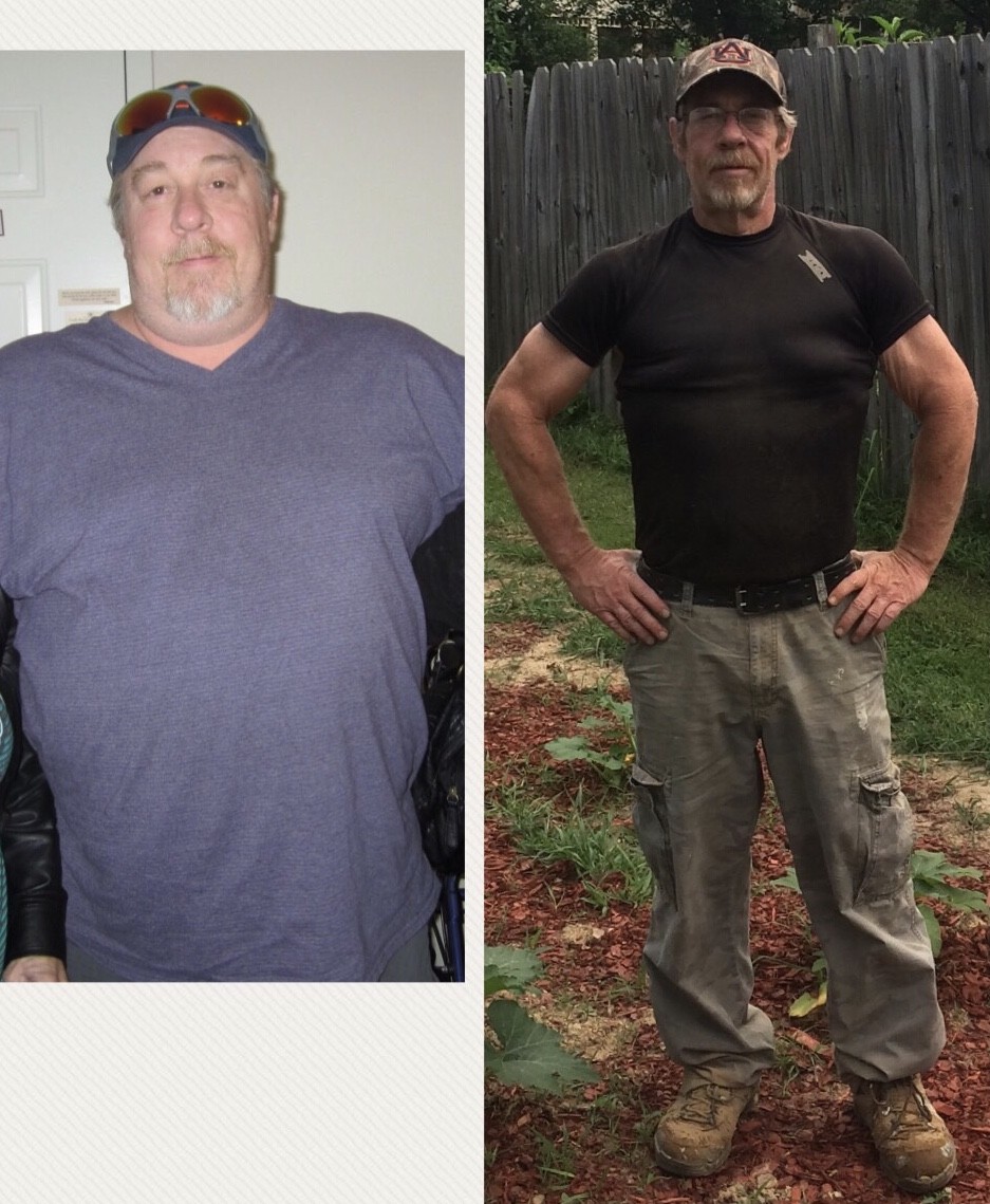 Scott's Testimonial: How Gastric Sleeve Surgery Gave Me My Life Back -  Birmingham Minimally Invasive Surgery