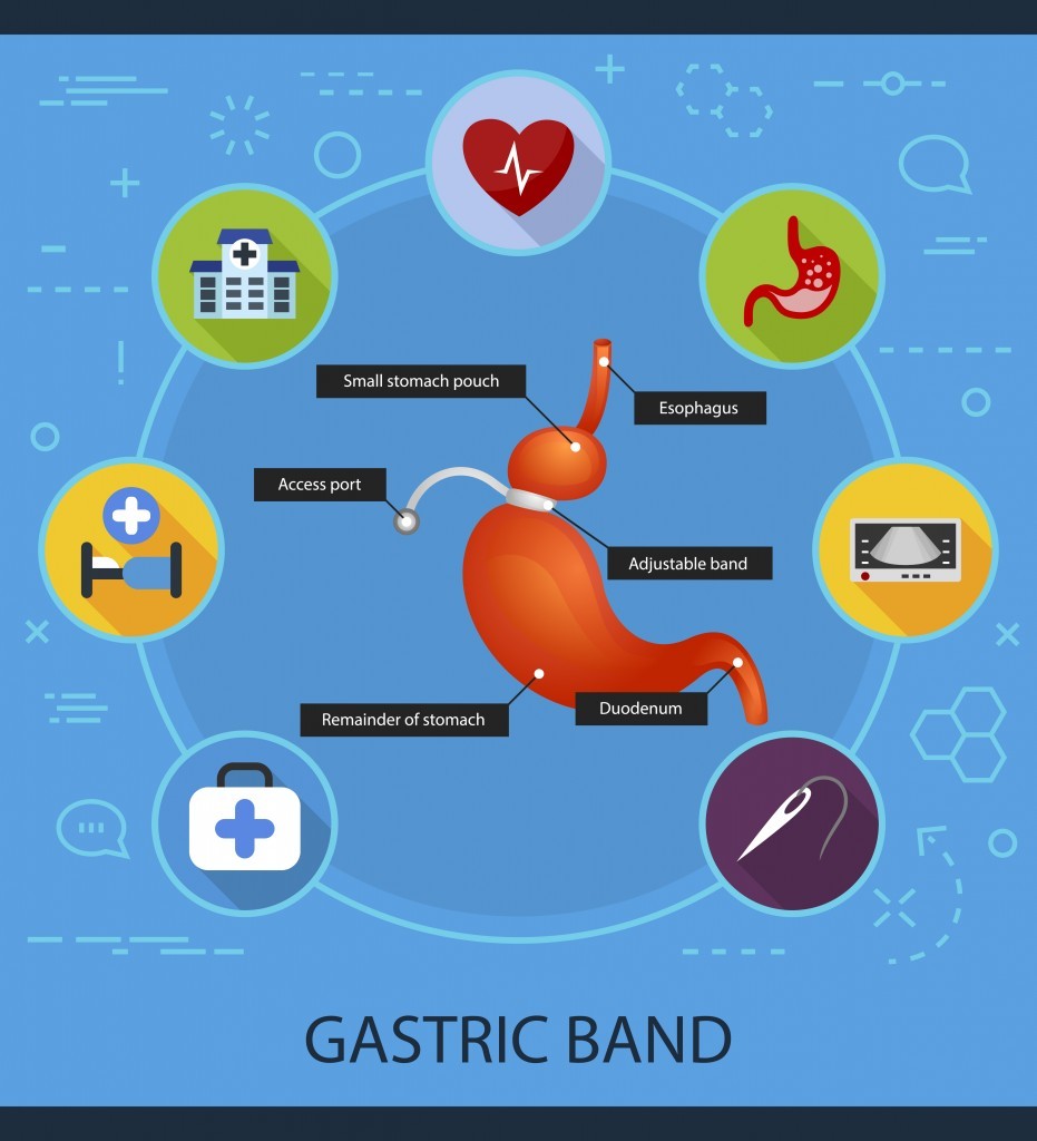 Gastric band flat icons concept. Vector illustration. Element template for design.