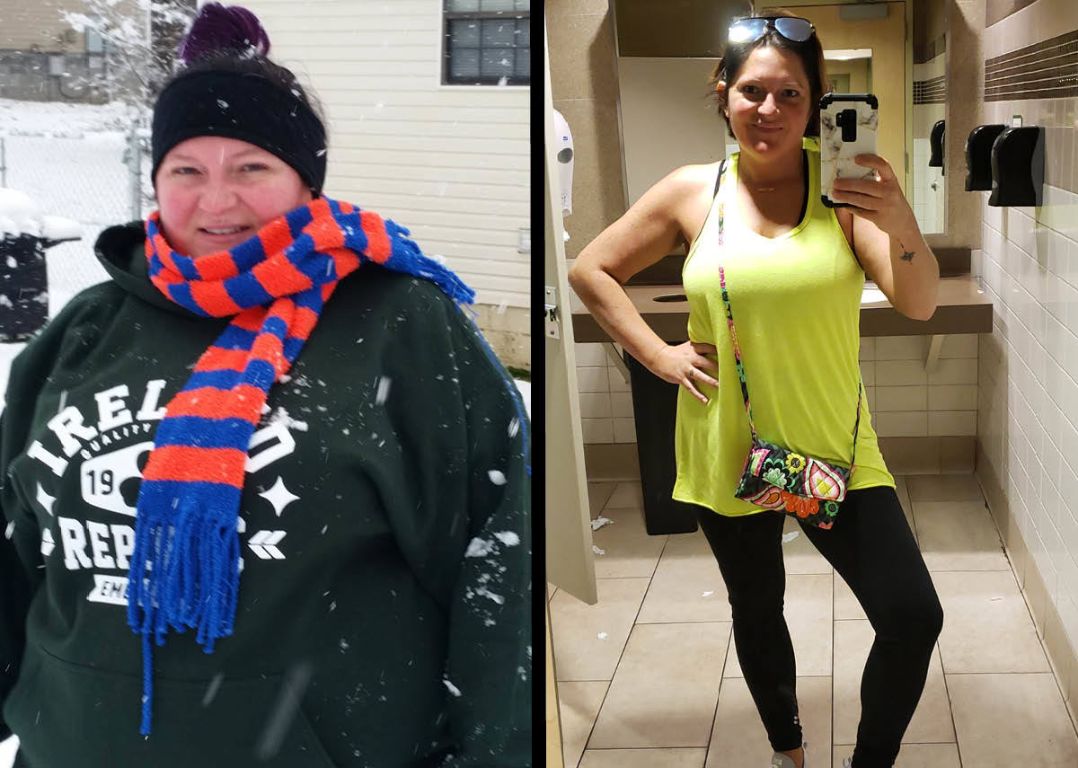 Tami’s Testimonial: Gastric sleeve surgery helped put me back in control of my life