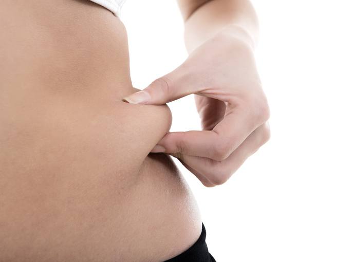 Will you have excess skin after weight loss surgery?