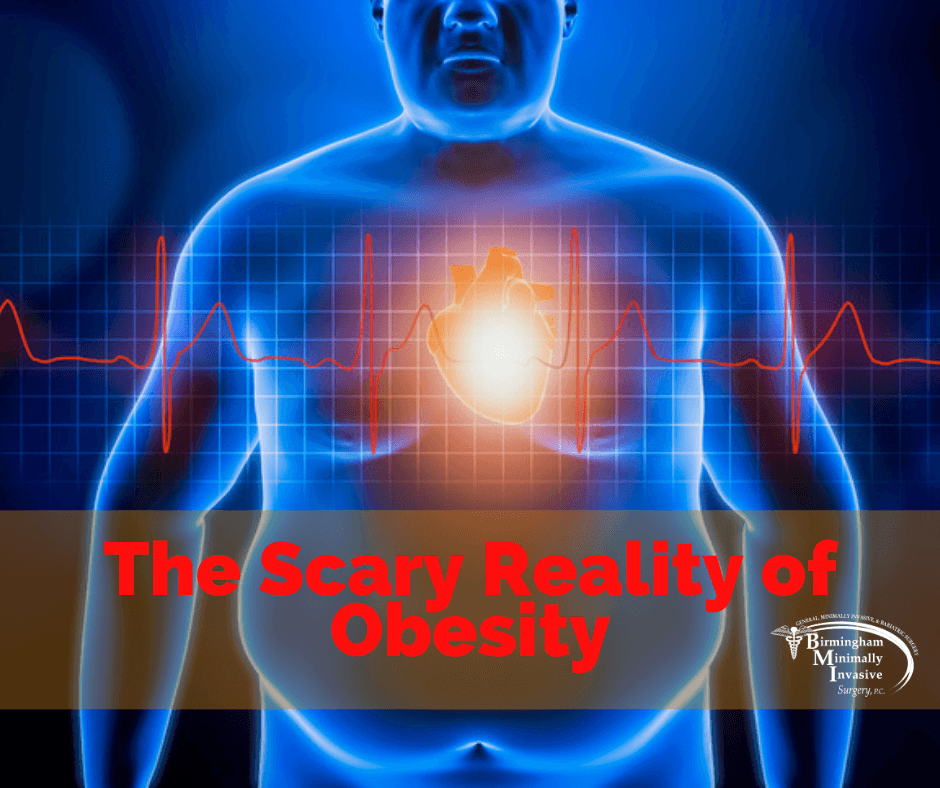 obesity, overweight