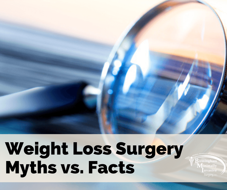 weight loss surgery myths