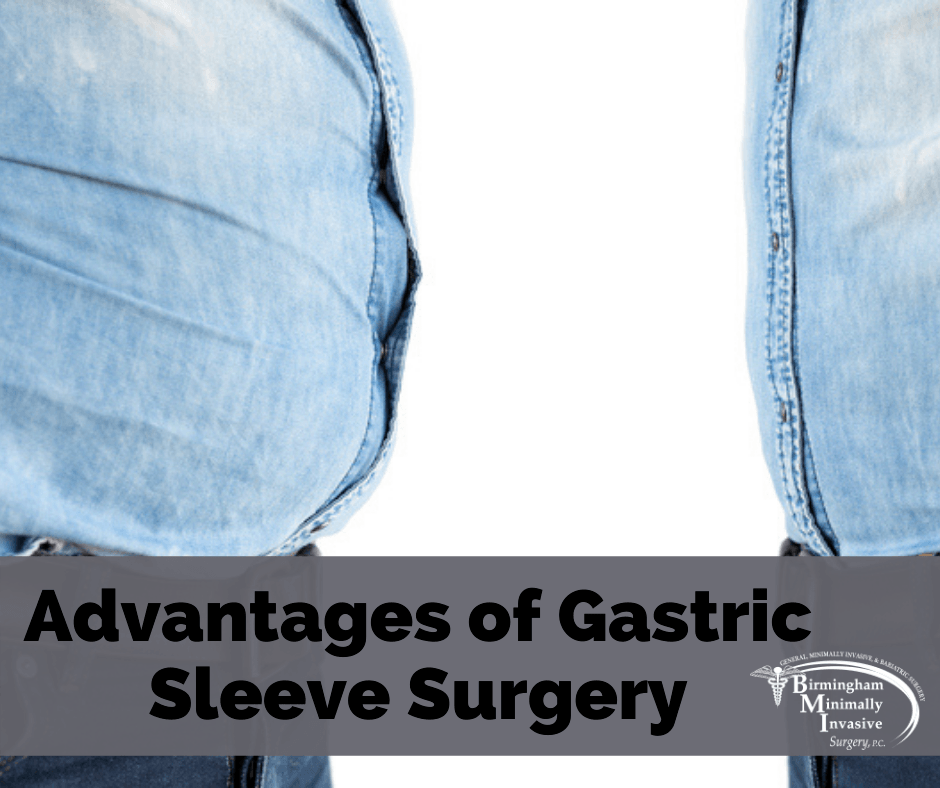 gastric sleeve advantages