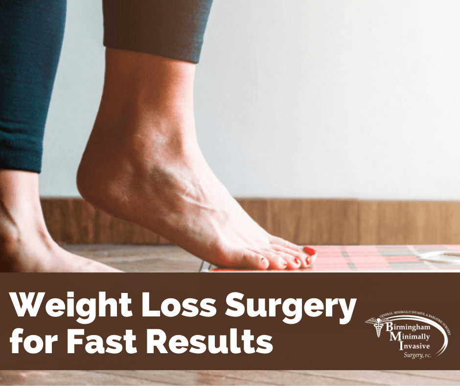 weight loss surgery results