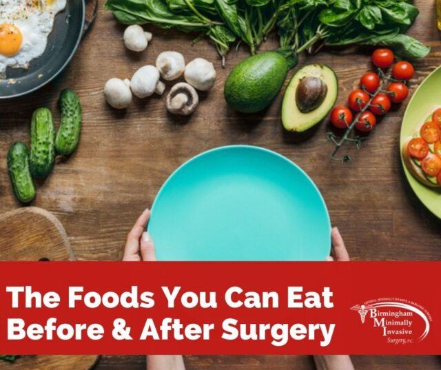 Weight Loss Surgery Diets What You Can Eat & When Birmingham