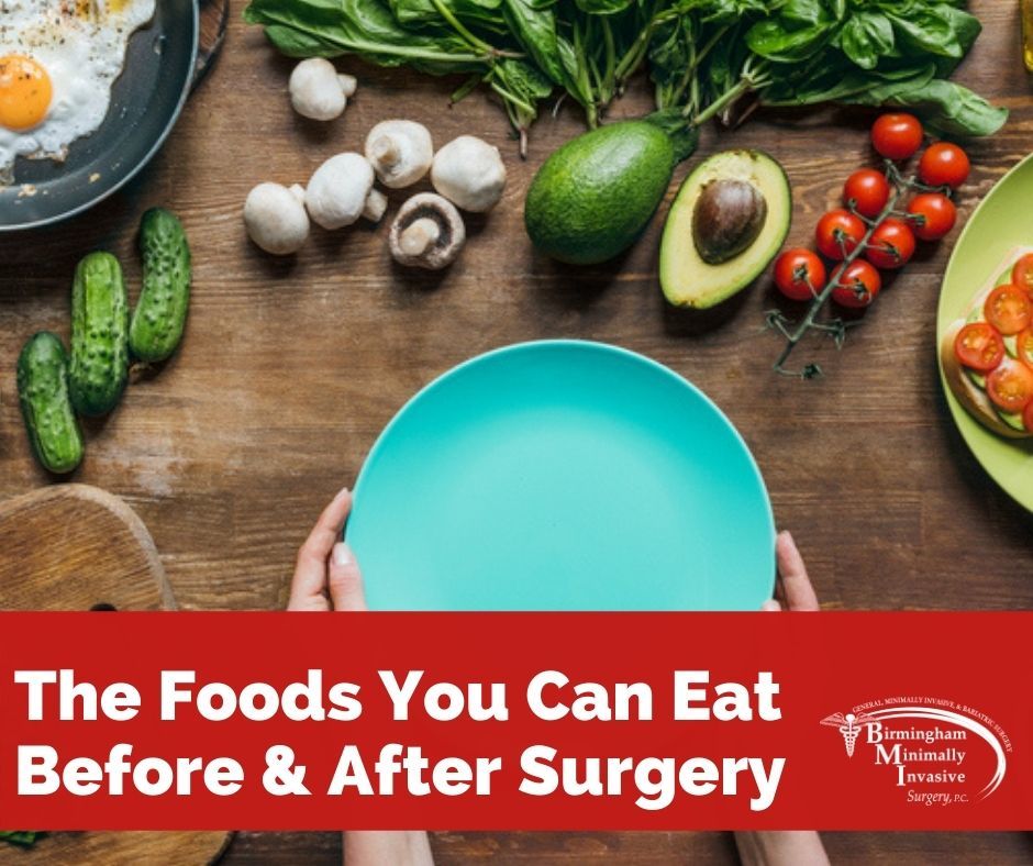 Weight Loss Surgery Diets: What You Can Eat & When