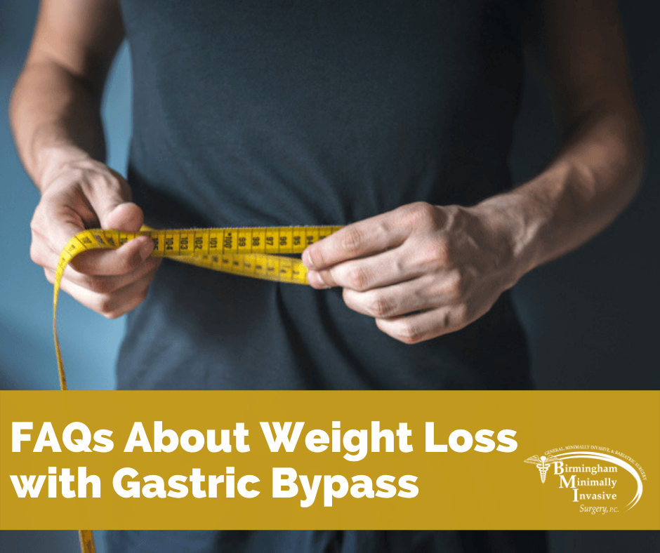 FAQs About Weight Loss With Gastric Bypass Surgery