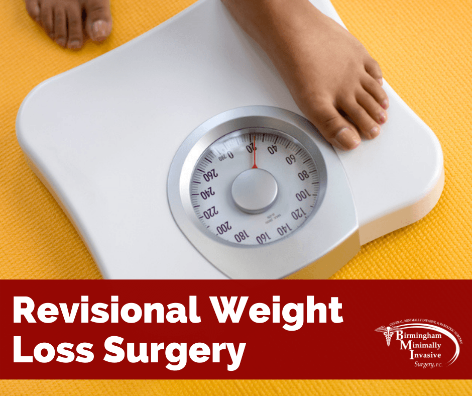 revisional weight loss surgery