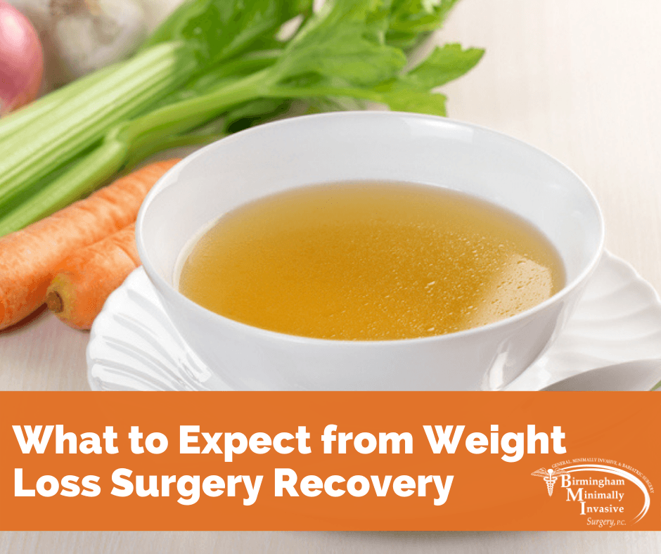 weight loss surgery recovery