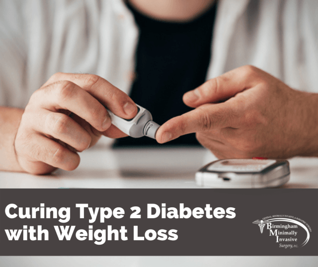 Curing Type 2 Diabetes With Weight Loss Birmingham Minimally Invasive