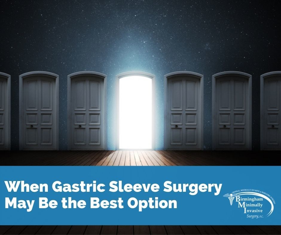 When Gastric Sleeve Surgery May Be the Best Option