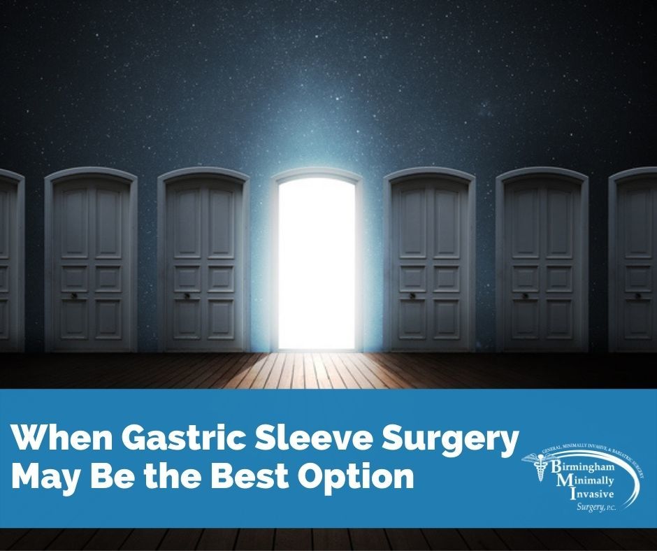 gastric sleeve surgery