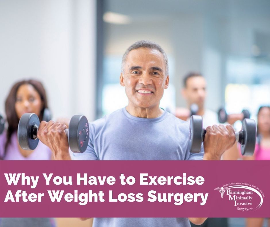 weight loss surgery exercise