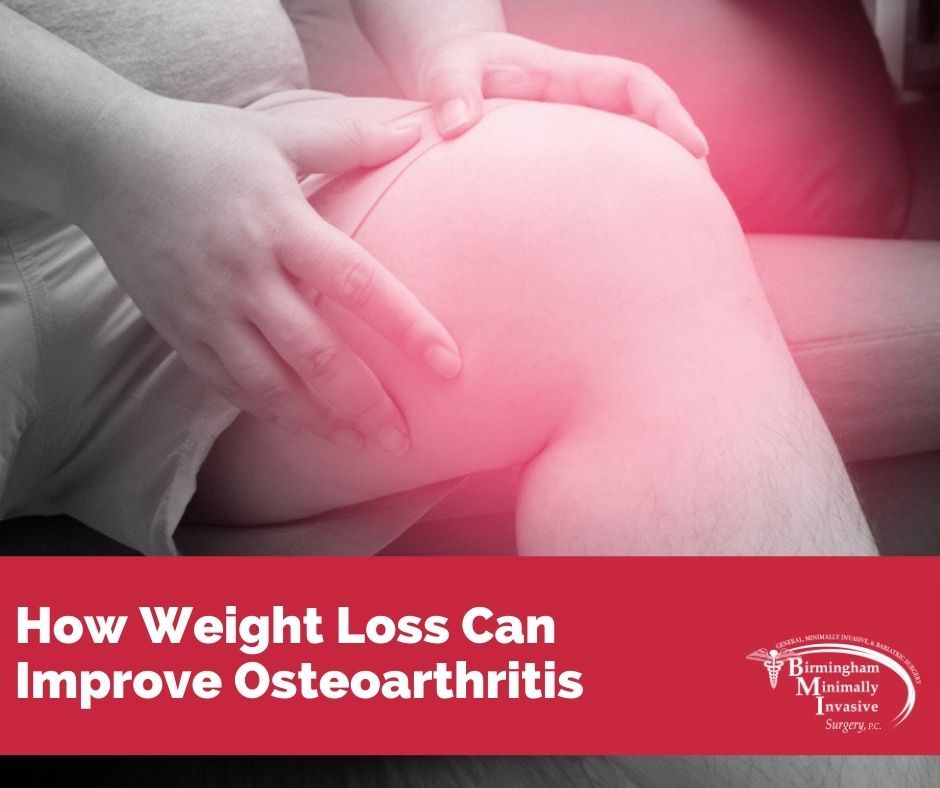 weight loss osteoarthritis