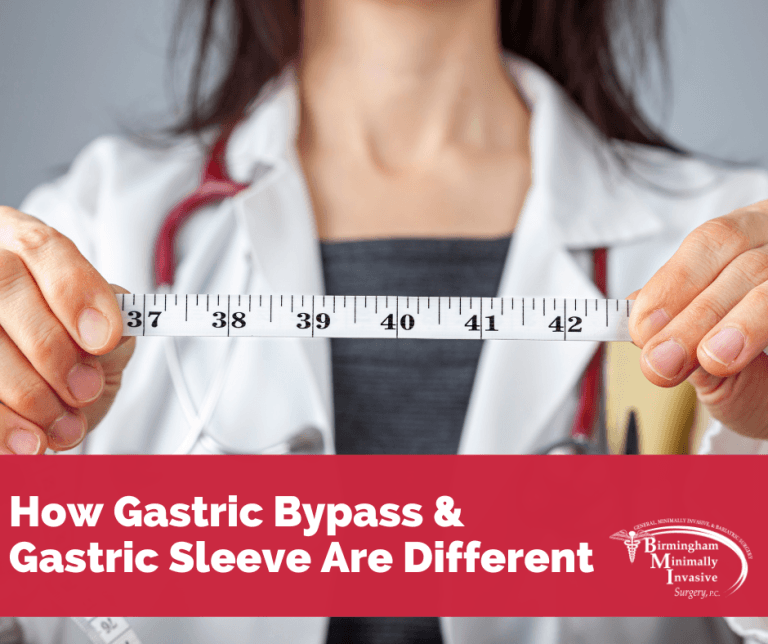 How Gastric Sleeve And Gastric Bypass Are Different Bmi Surgery