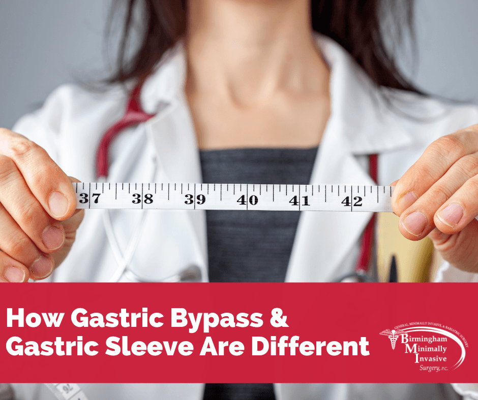 How Gastric Sleeve and Gastric Bypass Are Different