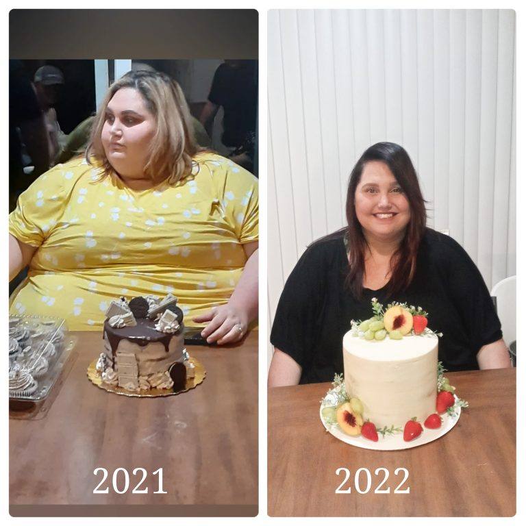 BMI Priority Pass Weight Loss Surgery Gastric Sleeve Surgery