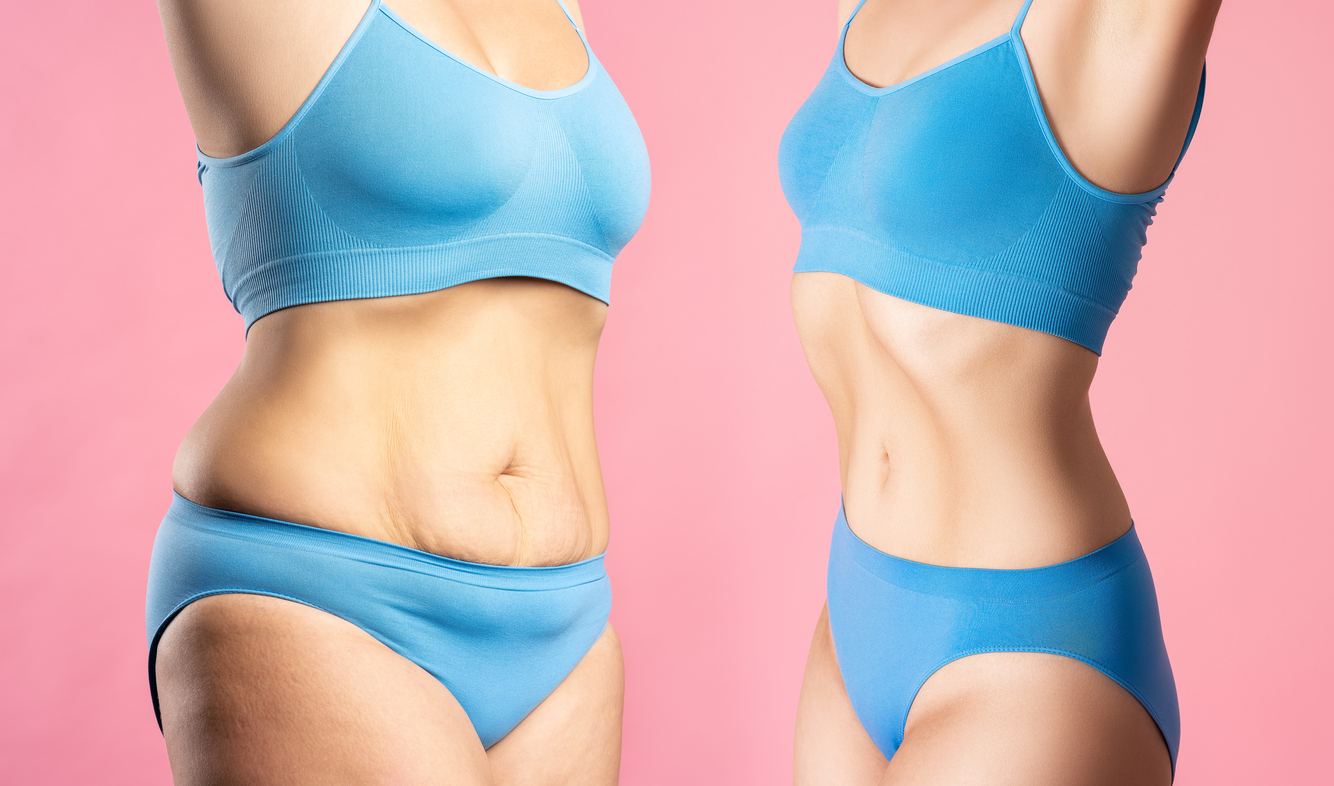 Woman's body before and after weight loss on pink background.