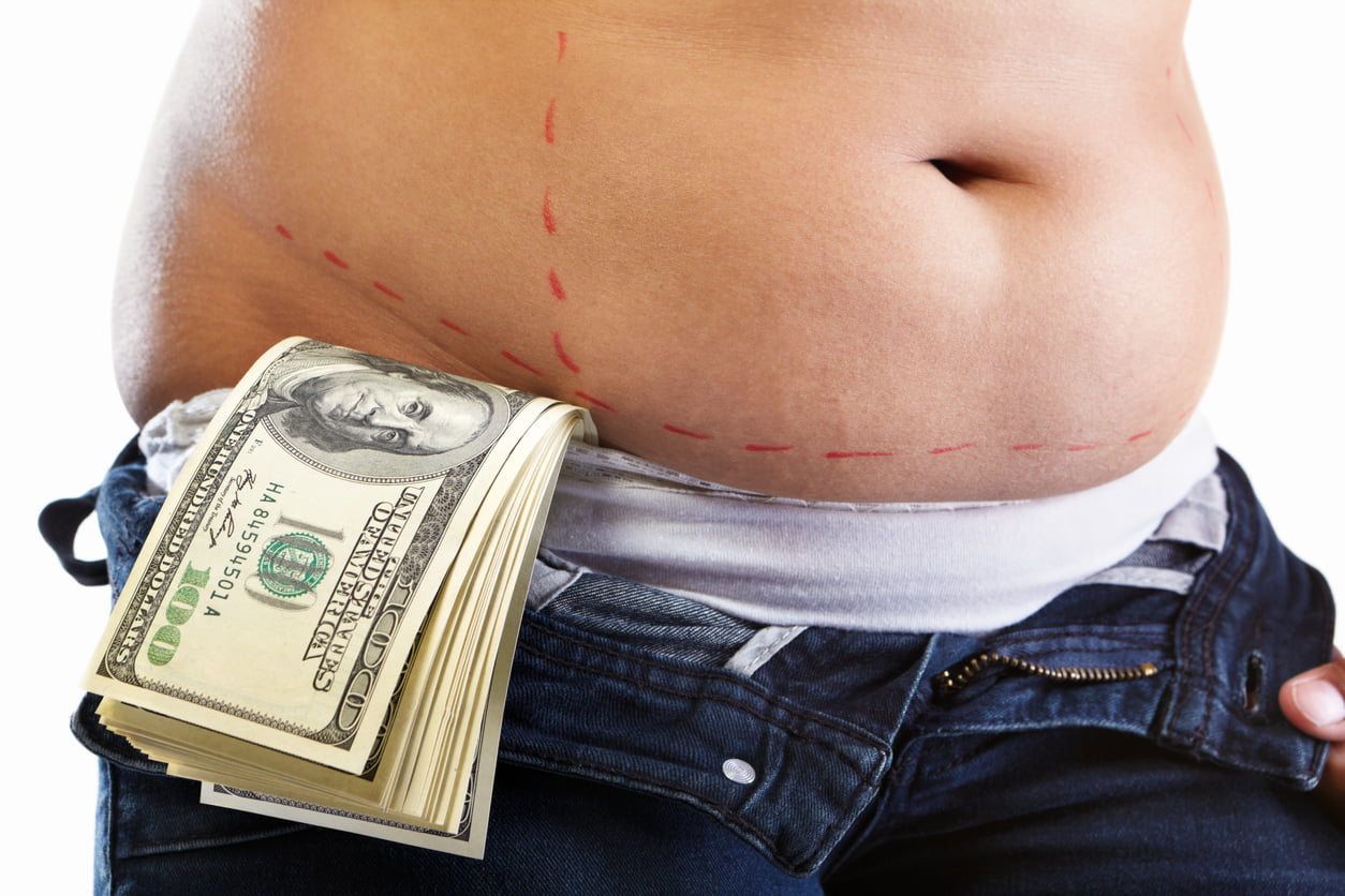 An adult midriff with weight loss surgery markings wearing jeans with a pile of hundred dollar bills sticking out.