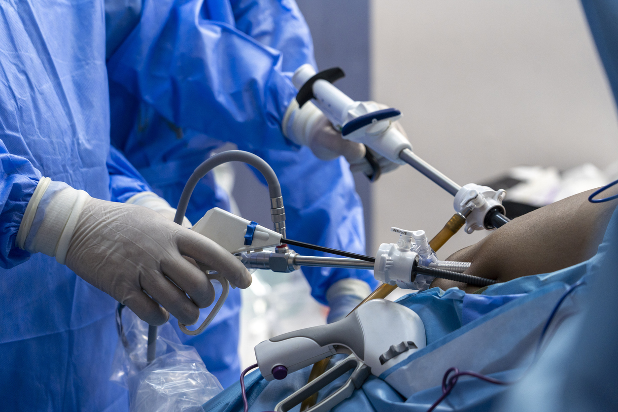 Weight Loss Surgery Reversibility Guide: Gastric Band, Sleeve, and Bypass Compared