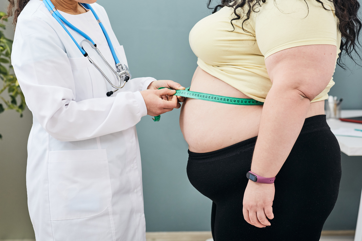 A doctor measures the waist of an obese woman to create a plan for weight loss. 